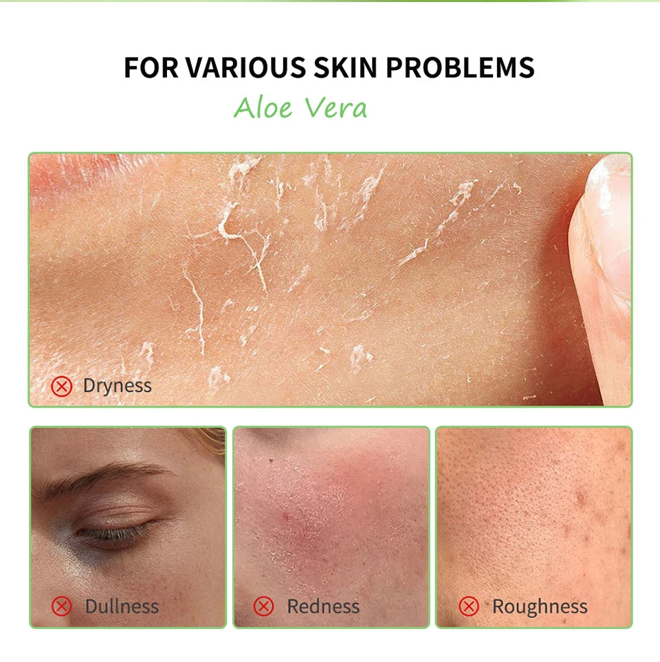 Hydrating Aloe Vera Gel for Soothing and Moisturizing Facial Skin Care
