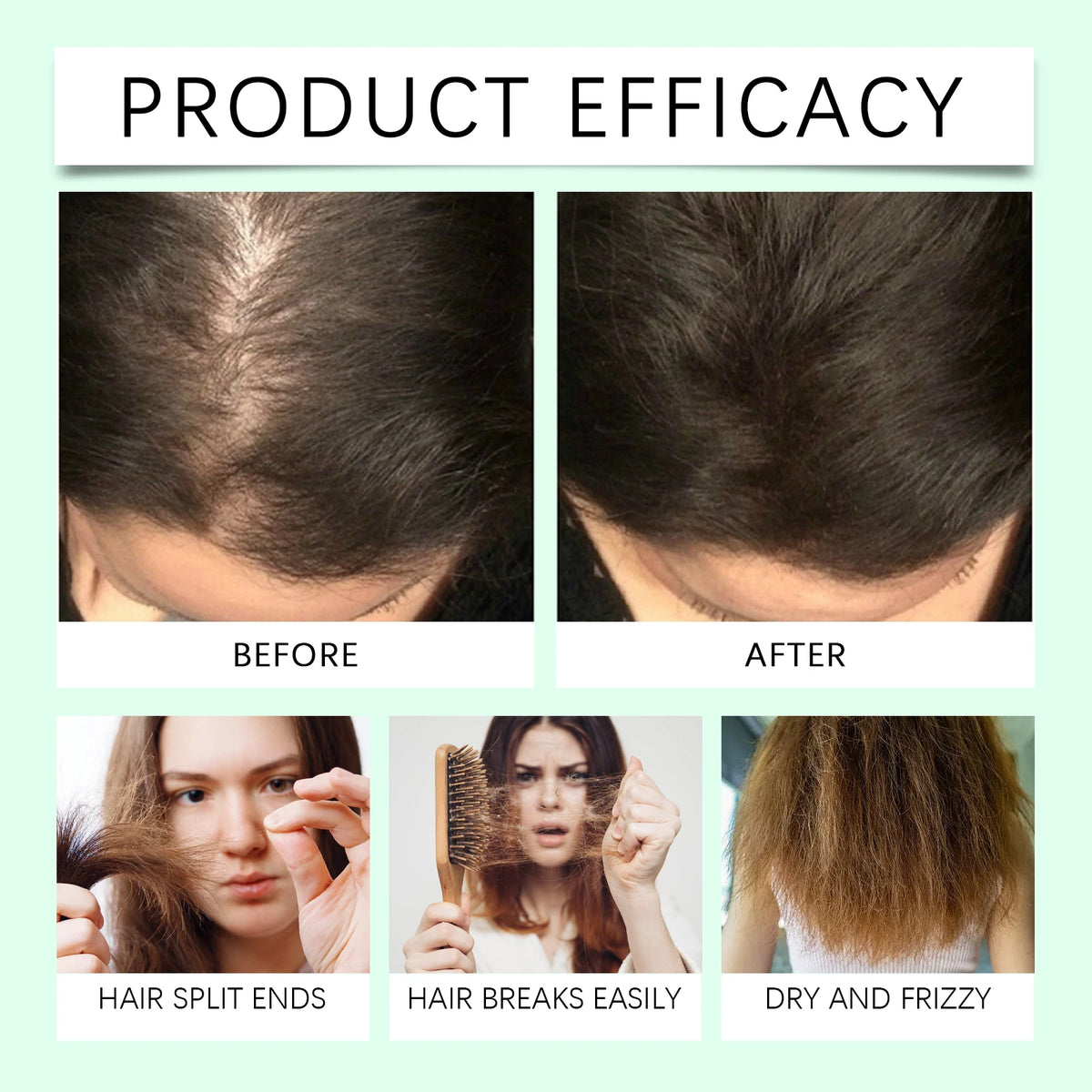 Rosemary Hair Growth Oil for Scalp Treatment and Thickening