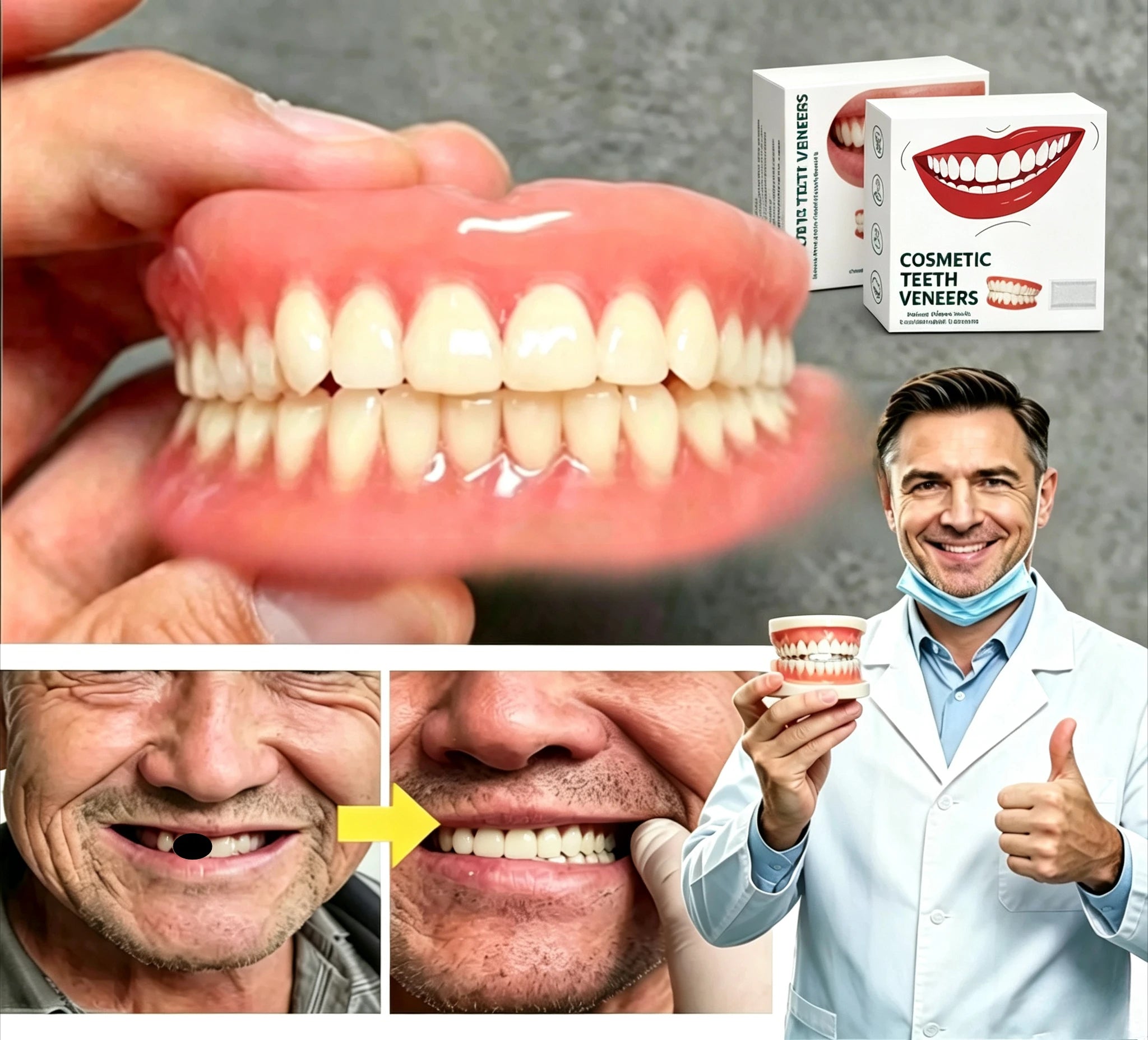 Custom Fit Temporary Denture Veneers for Instant Natural Smile Restoration - 4