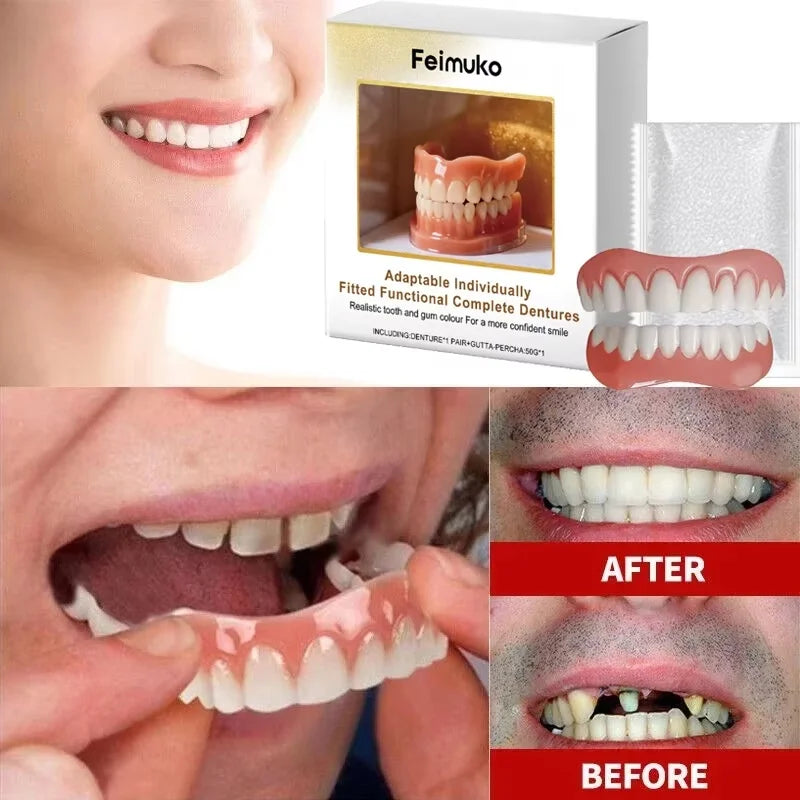 Custom Fit Cosmetic Dentures for a Confident Natural Smile - 2