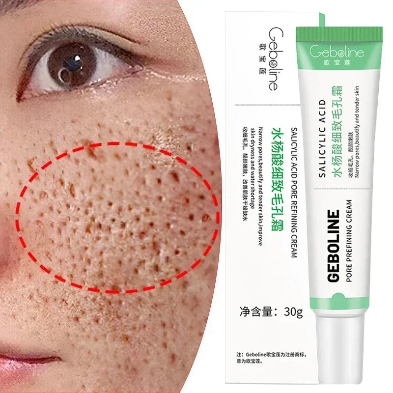 Salicylic Acid Pore Refining Cream for Smooth and Clear Skin