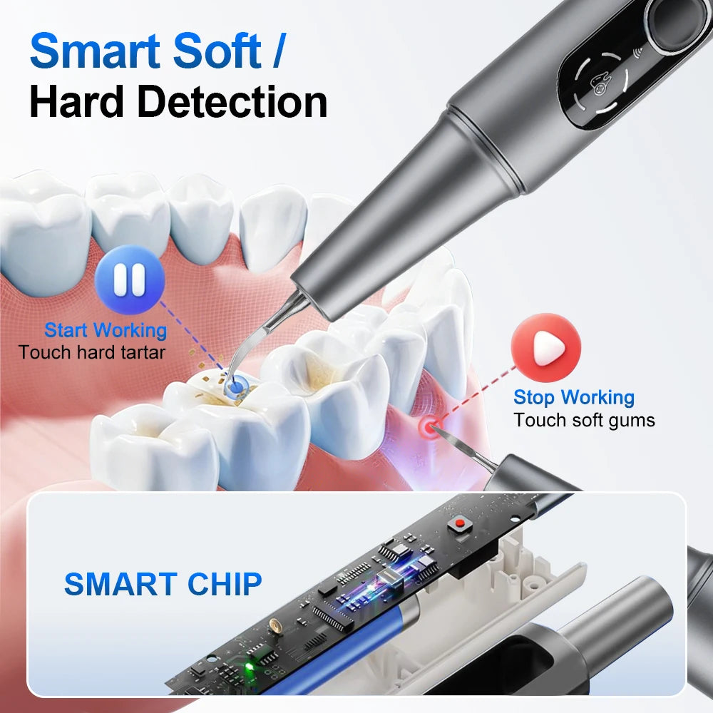 Visual Ultrasonic Dental Scaler with HD Camera for Plaque Tartar Removal