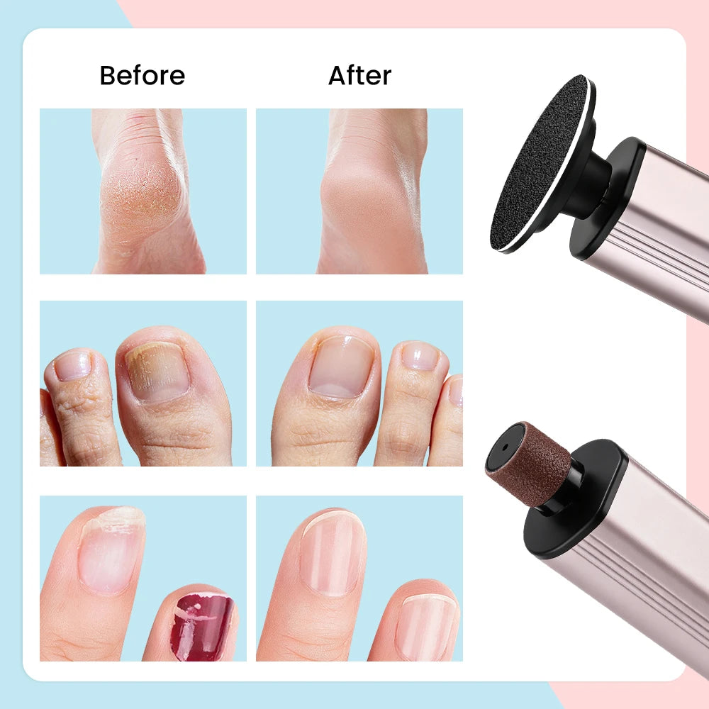 Electric Rechargeable Foot Callus Remover and Nail Polishing Care Tool - 11