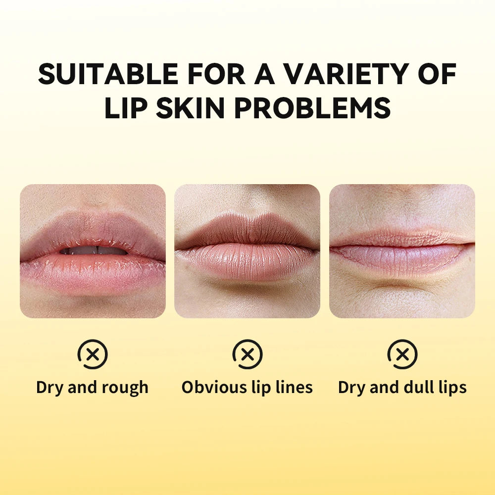 Propolis Hydrating Lip Repair Gel for Smooth and Soft Lips - 5