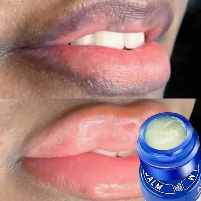 Moisturizing Lip Balm for Dark Pigmentation and Dryness Repair - 1