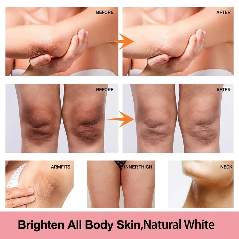 Vitamin C Brightening Cream for Dark Spots Underarms Elbows and Knees