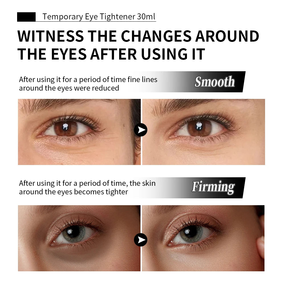 Instant Eye Tightening Cream for Fine Lines and Dark Circles
