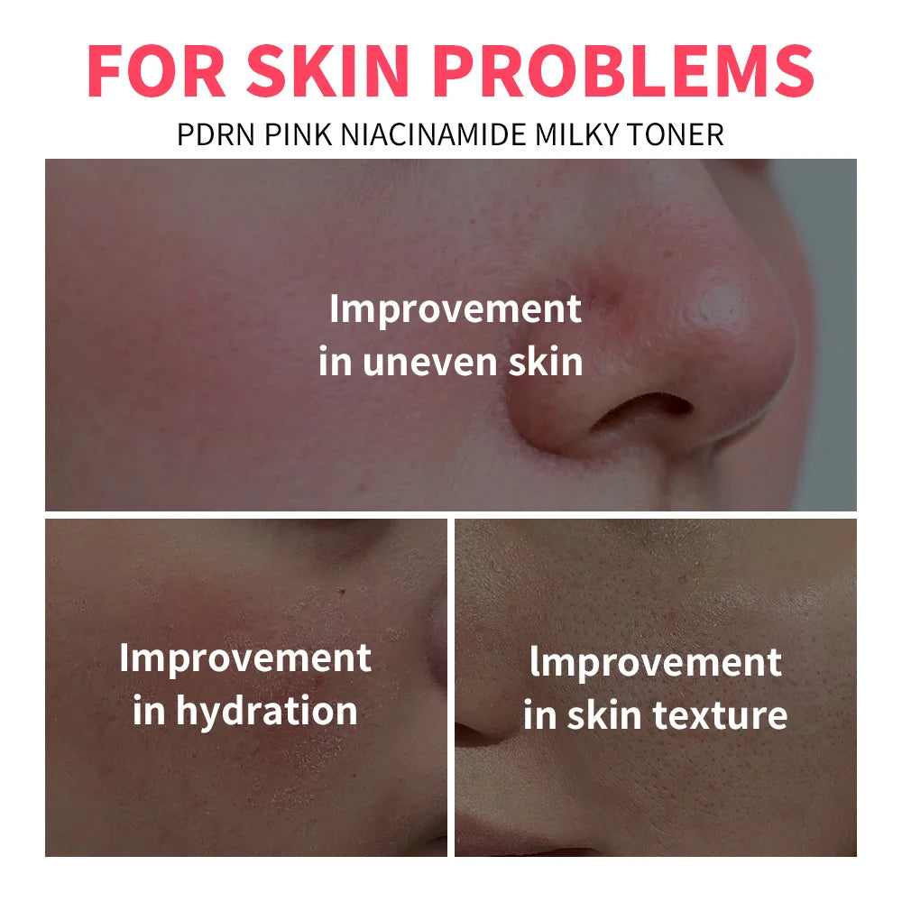 PDRN Niacinamide Milky Toner for Deep Hydration and Glowing Radiant Skin - 6