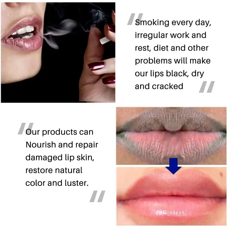 Moisturizing Lip Balm for Dark Pigmentation and Dryness Repair - 6