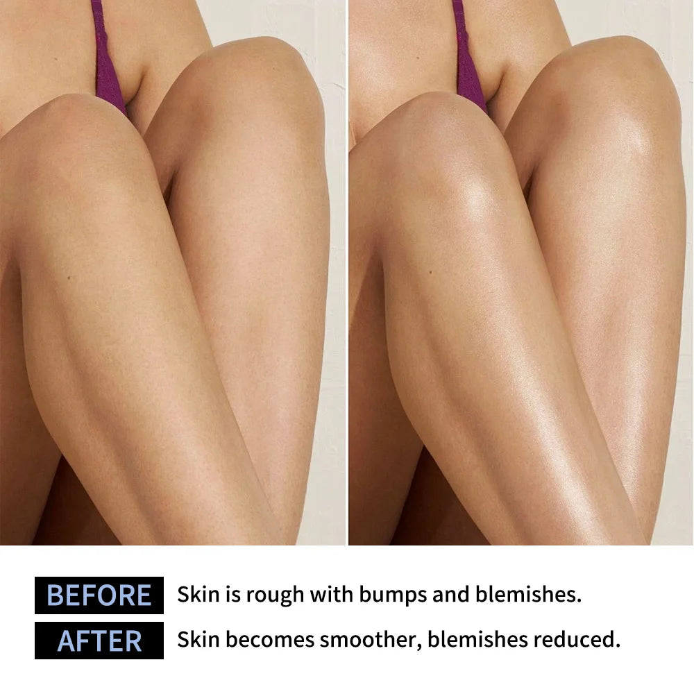 Glycolic Acid Exfoliating Body Stick for Smooth and Radiant Skin - 4