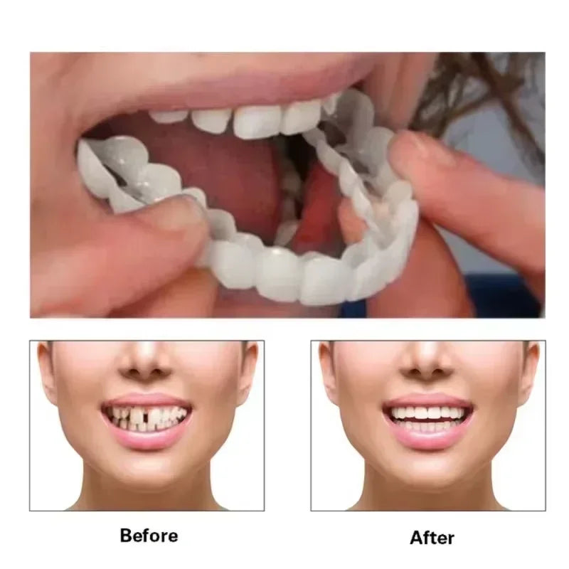 Comfortable Silicone Denture Liner Kit for Instant Smile Enhancement - 1