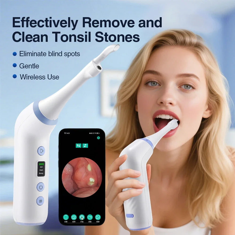 HD Visible Tonsil Stone Remover and Oral Vacuum Cleaning Tool - 1