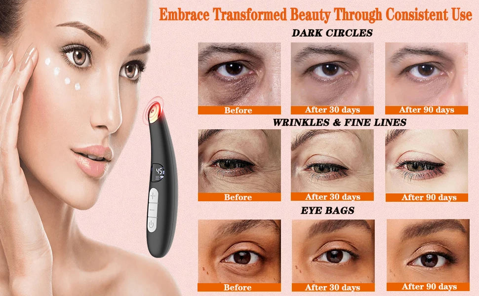 3-in-1 Heated Eye Wand for Dark Circles, Puffiness and Skin Rejuvenation - 10