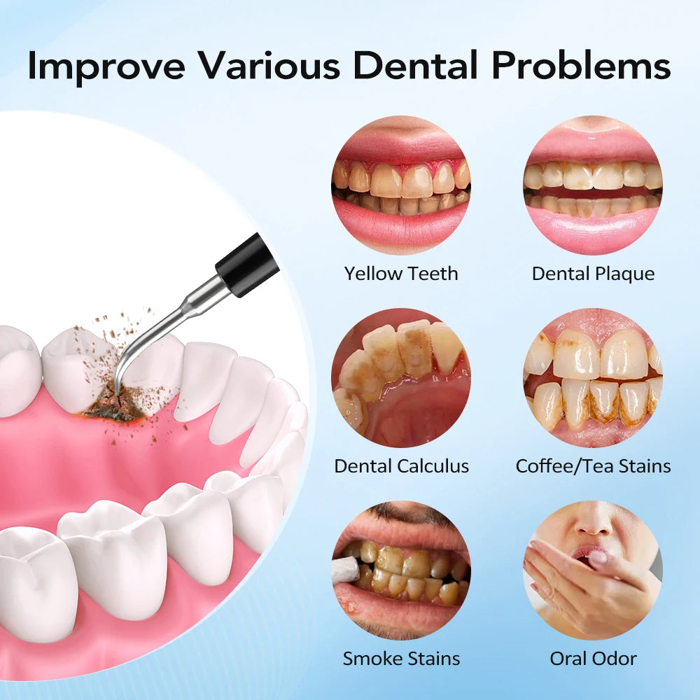 Electric Sonic Teeth Cleaner for Plaque and Tartar Stain Removal - 11