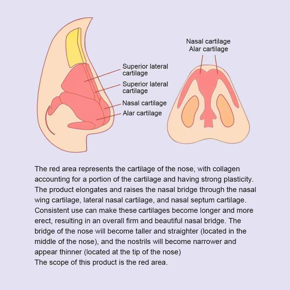 EMS Nose Lifting and Sculpting Beauty Massager Clip - 10