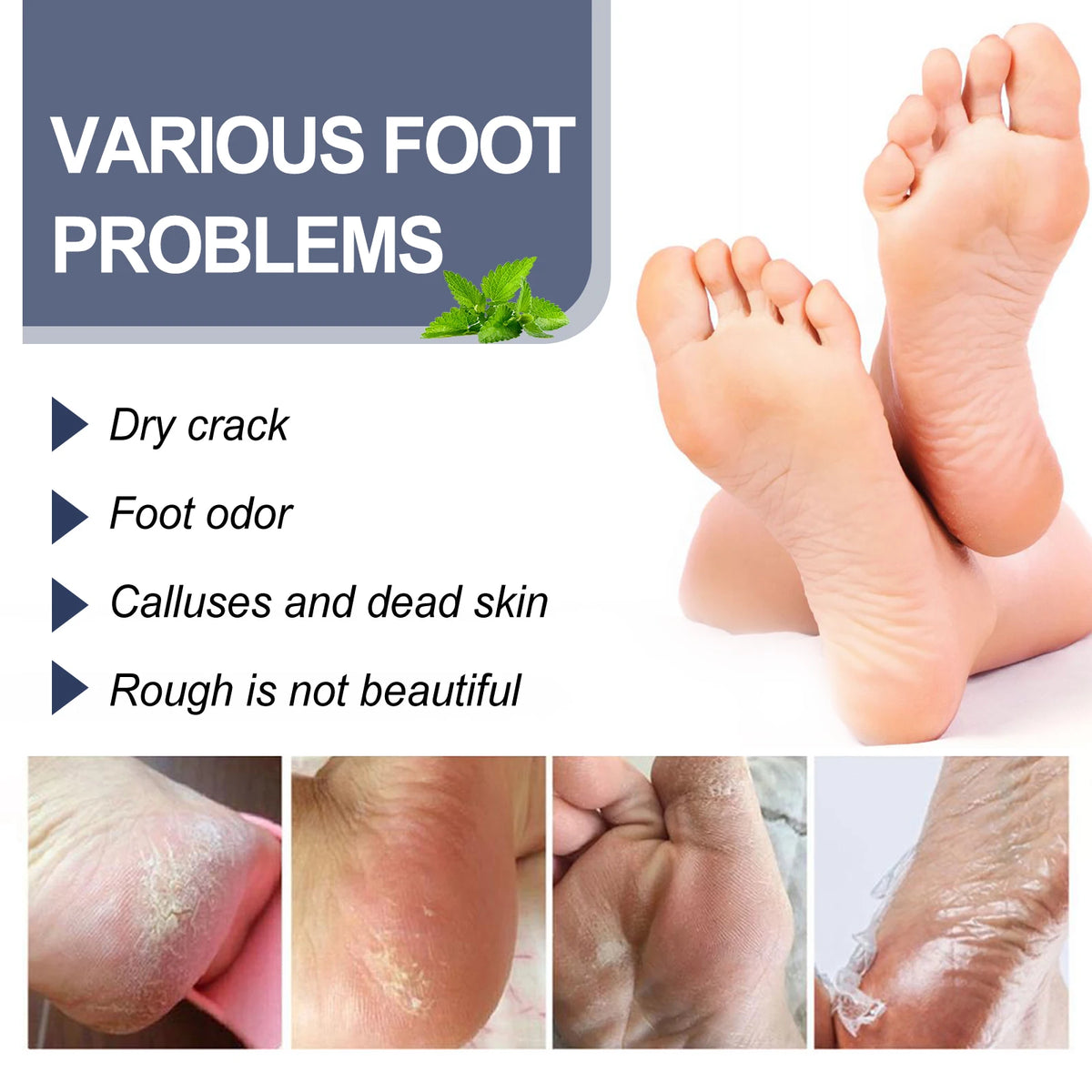 Refreshing Foot Deodorant Spray for Odor Removal and Hydrating Dry Heels