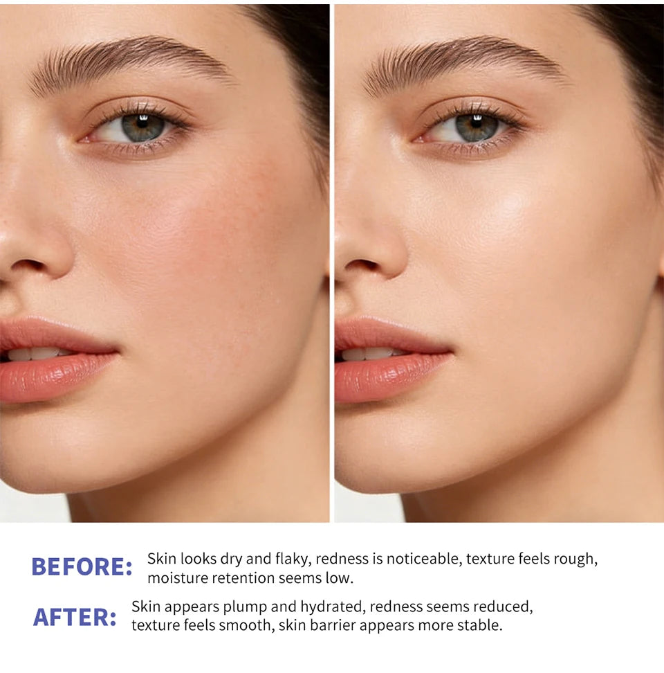 Triple Lipid Peptide Moisturizing Face Cream for Dry and Sensitive Skin