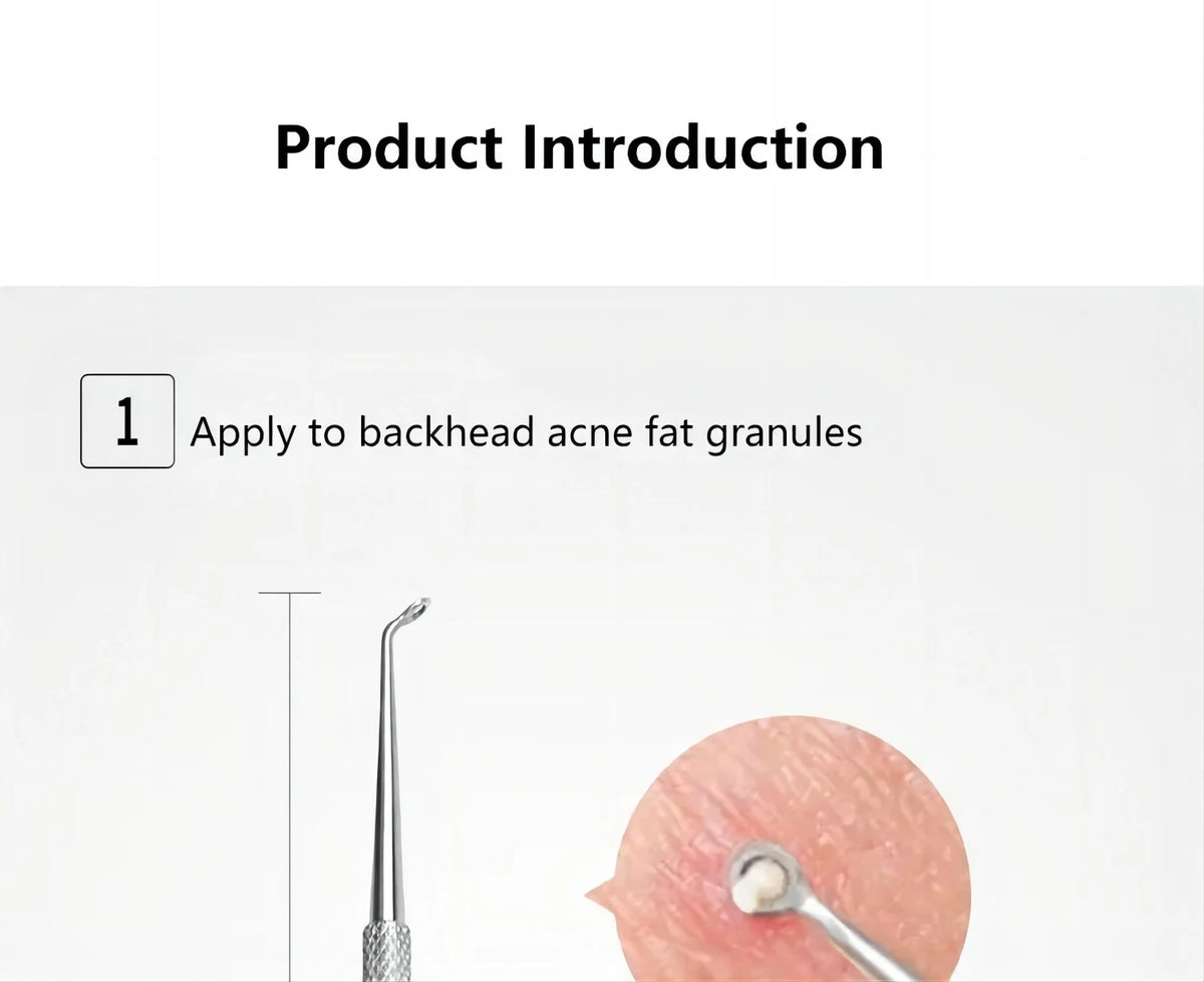 Professional Stainless Steel Blackhead and Pimple Extractor Tool Kit
