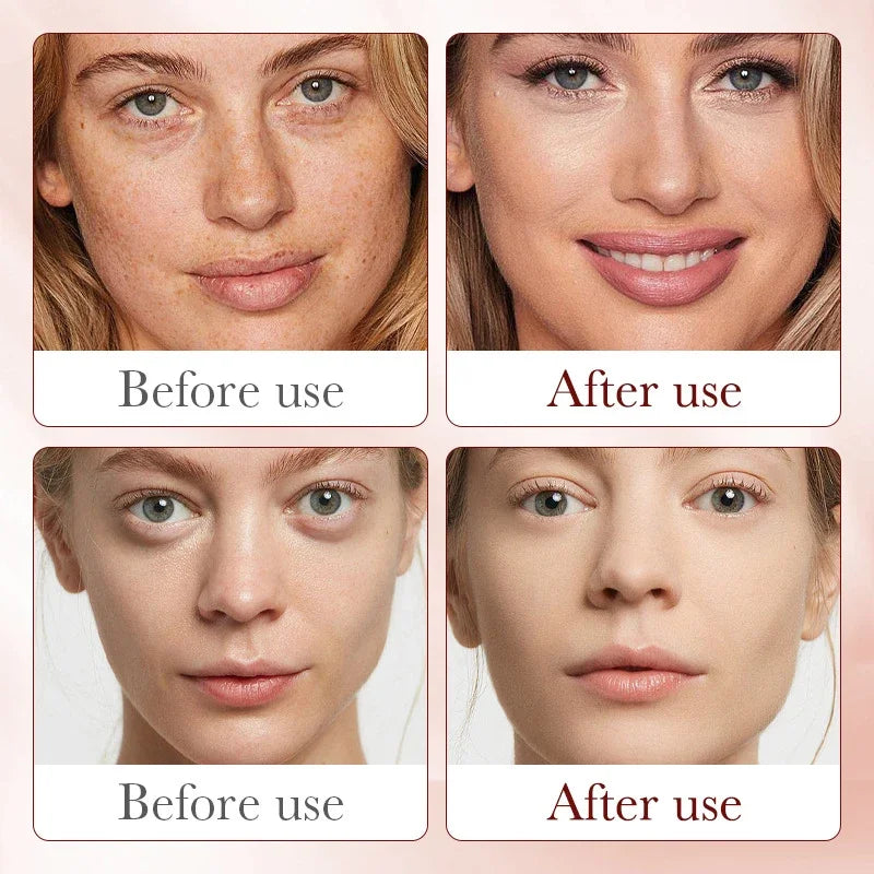Anti-Aging Dragon Blood Facial Serum for Wrinkle Reduction and Firming