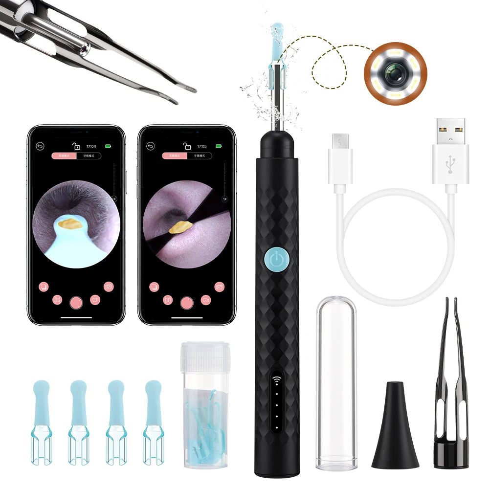 Smart Visual Ear Wax Removal Tool with HD Camera and Tweezers - 8