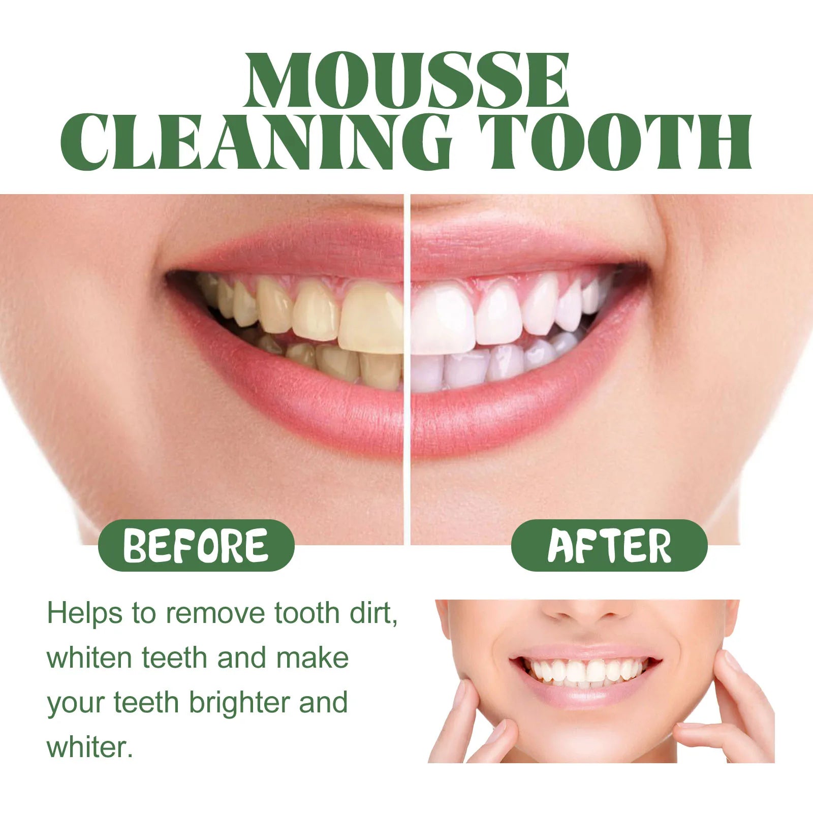 Foaming Teeth Whitening Mousse for Stain Removal and Fresh Breath - 13