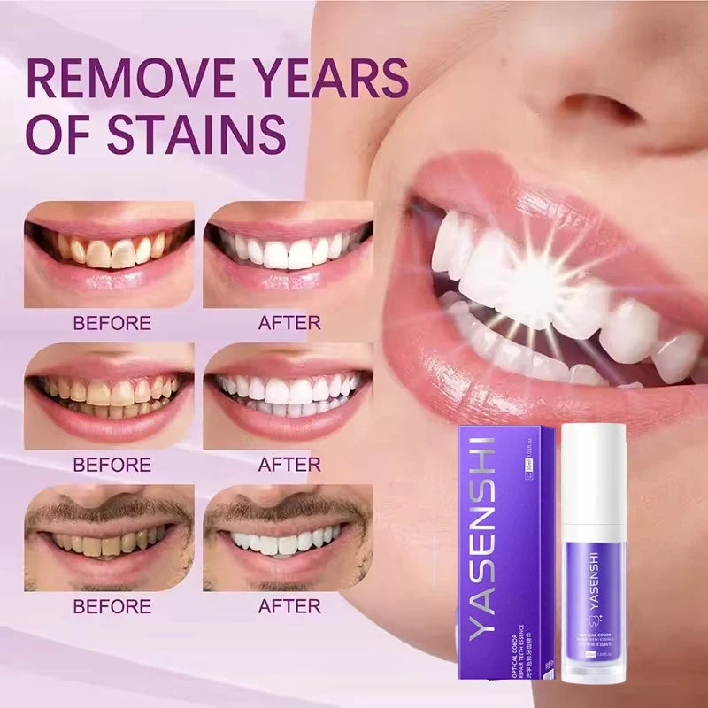 Deep Cleaning Whitening Toothpaste for Brighter Smiles and Fresh Breath - 2