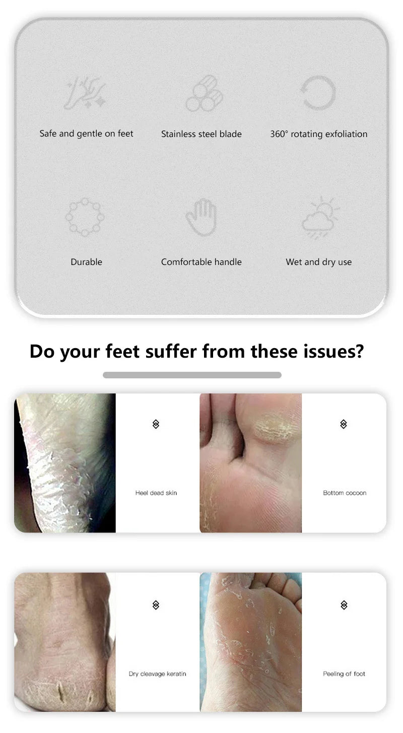 Professional Stainless Steel Foot File for Cracked Heels and Callus Removal - 9