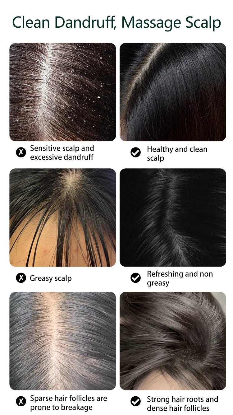 Electric Scalp Massager for Stress Relief and Hair Care