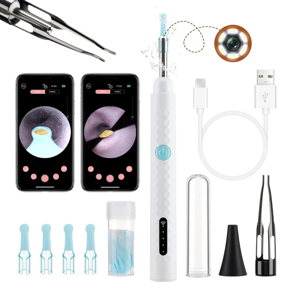 Smart Visual Ear Wax Removal Tool with HD Camera and Tweezers - 1