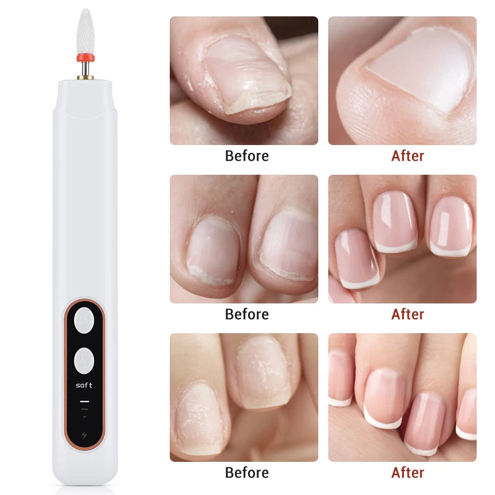 Professional Cordless Electric Nail File and Manicure Pedicure Drill Kit - 5