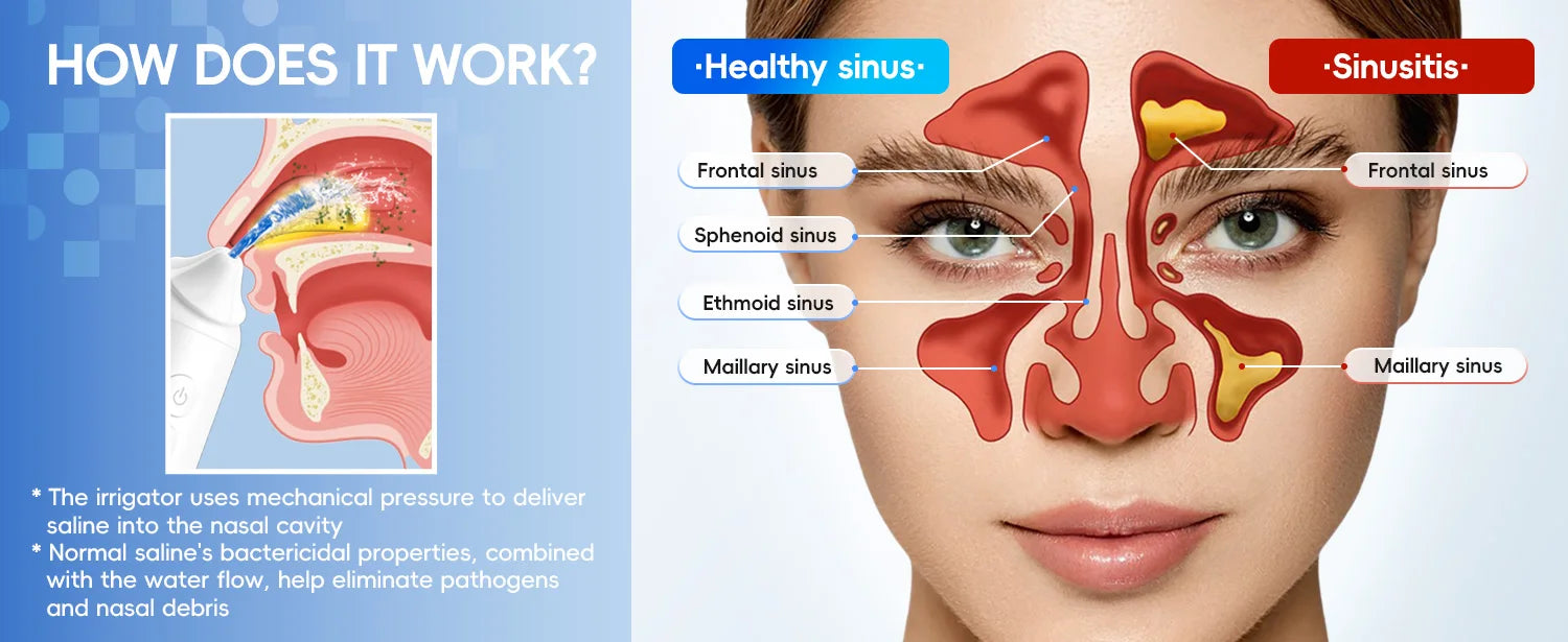 Electric Nasal Irrigation System for Sinus Relief and Allergy Cleaning - 9