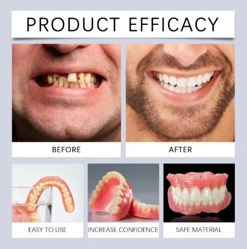 Comfort Fit Cosmetic Silicone Teeth Veneers for Natural Smile Enhancement