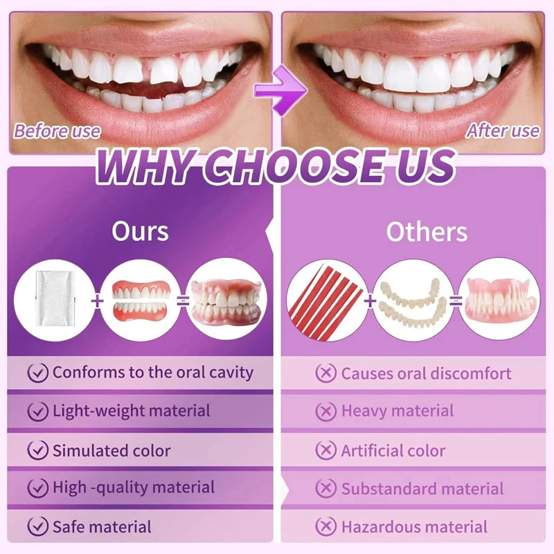 Comfortable Silicone Full Set Dentures for Instant Smile Enhancement