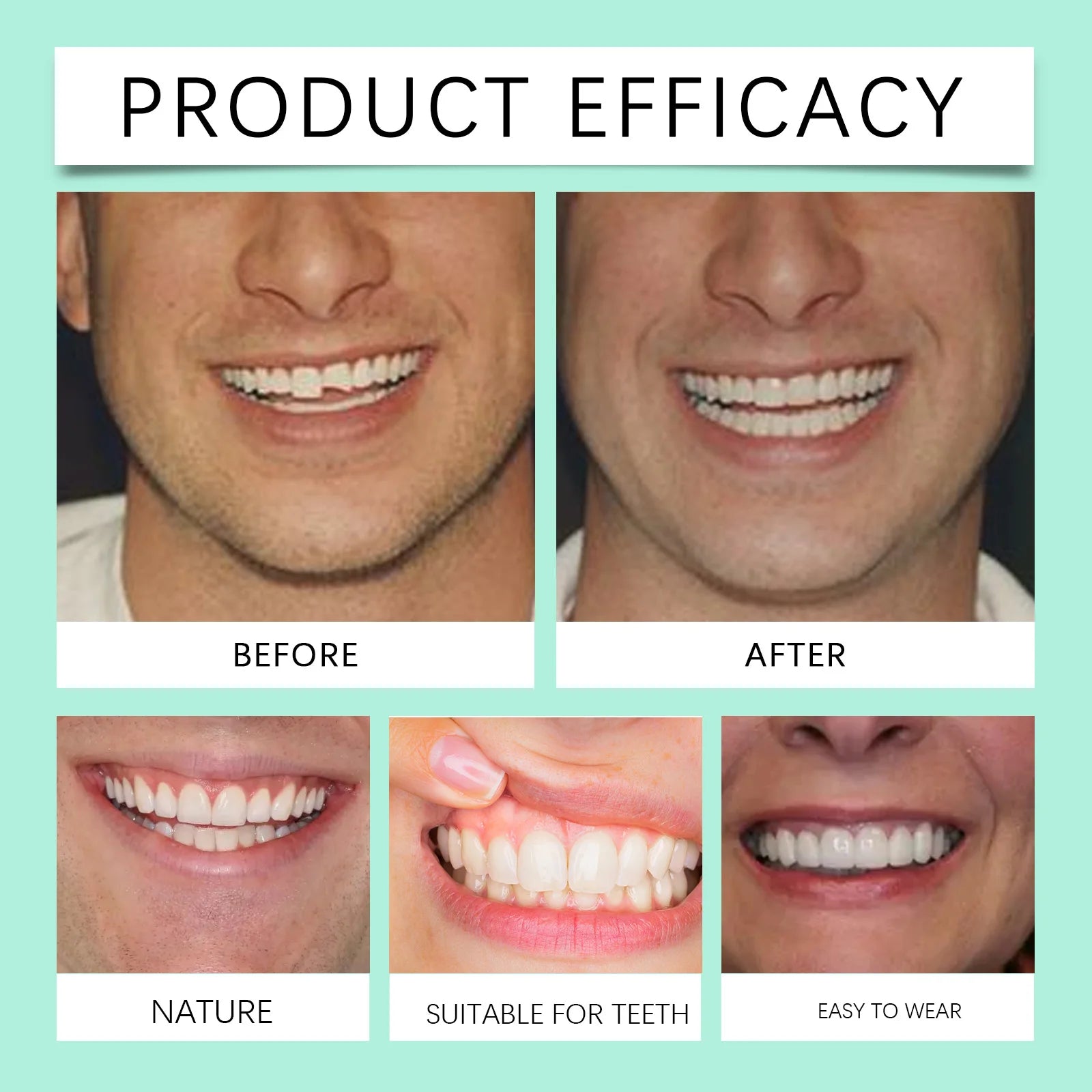 Flexible Silicone Cosmetic Denture Set for a Natural Radiant Smile - 12