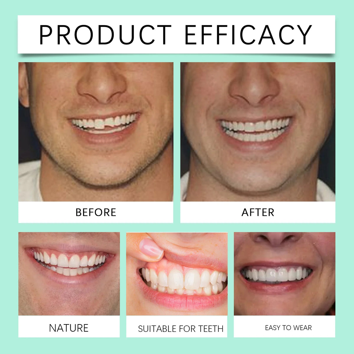 Flexible Silicone Cosmetic Denture Set for a Natural Radiant Smile