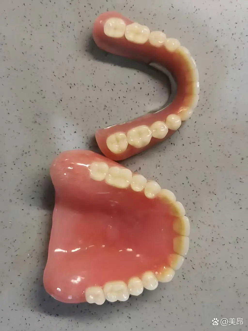 Comfortable Silicone Cosmetic Veneers for a Realistic Instant Smile - 2