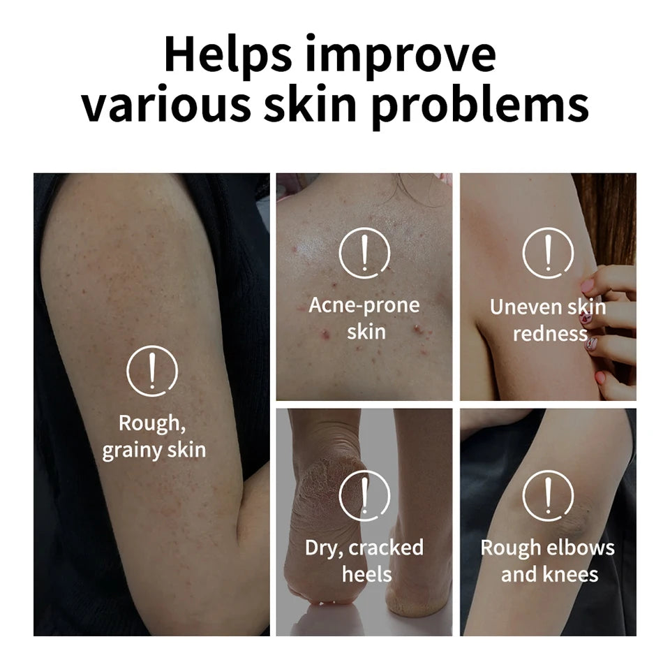 Glycolic Acid Exfoliating Body Stick for Smooth and Radiant Skin - 11