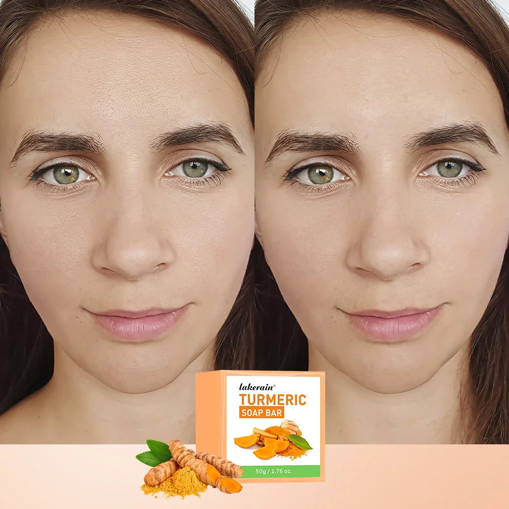 Brightening Turmeric Soap Bar for Face and Body Deep Cleansing