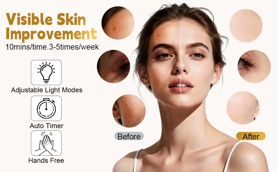 7-Color LED Silicone Facial Mask for Skin Rejuvenation and Firming - 9