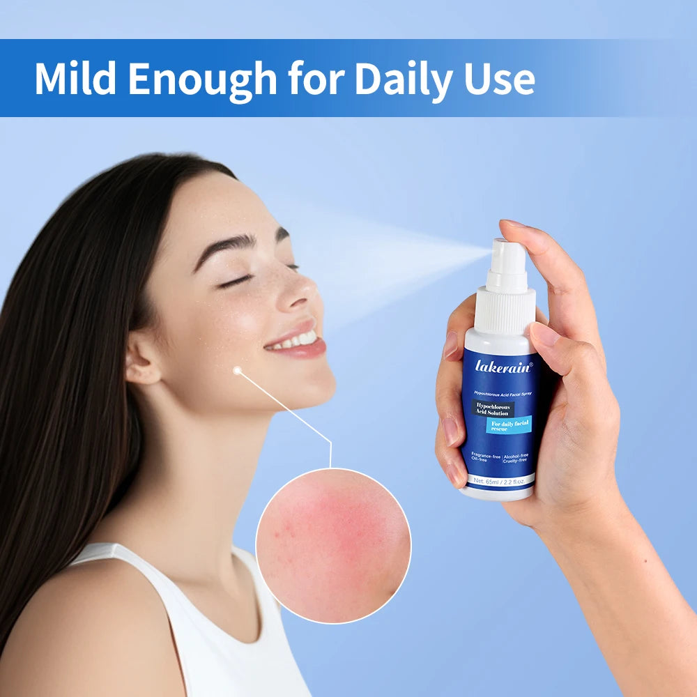 Hypochlorous Acid Facial Spray for Acne Redness and Piercing Aftercare